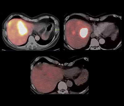 neuroendocrine