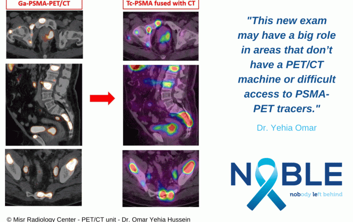 NOBLE Registry - Promising results with Tc-99m-iPSMA