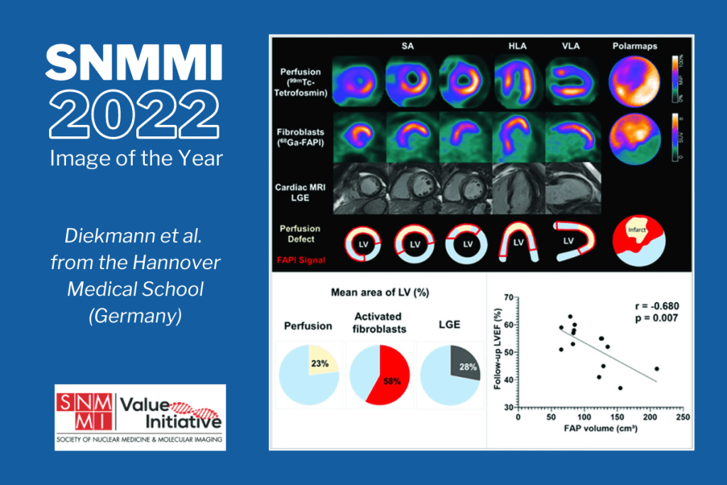 © 2022 by the Society of Nuclear Medicine and Molecular Imaging.