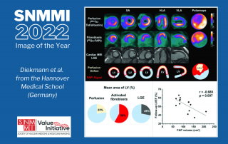 © 2022 by the Society of Nuclear Medicine and Molecular Imaging.