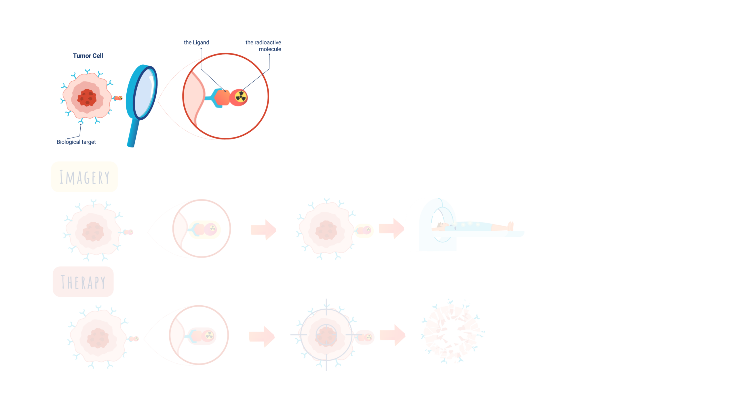 TRT - How does it work - Targeting the tumor