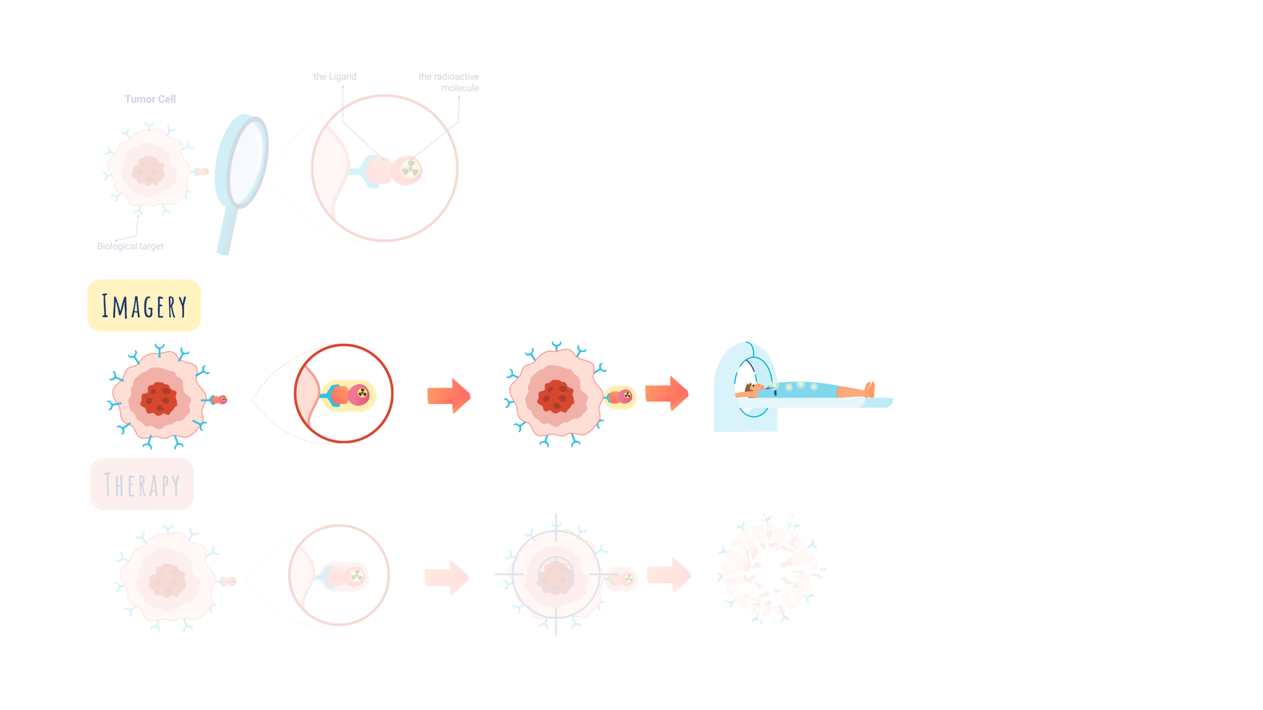 TRT - How does it work? See it