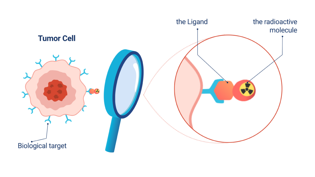 Targeted Radionuclide therapy, Ligand and radioactive molecule on cancer cell